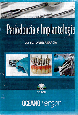 PERIODONCIA E IMPLANTOLOGIA + CD-ROM