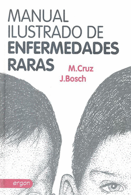 MANUAL ILUSTRADO DE ENFERMEDADES RARAS