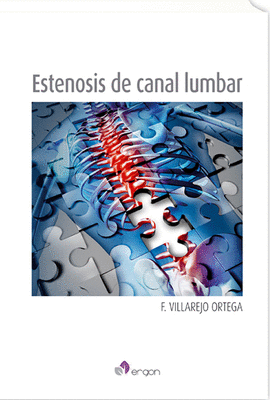 ESTENOSIS DE CANAL LUMBAR