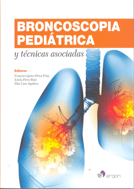 BRONCOSCOPIA PEDIATRICA Y TECNICAS ASOCIADAS
