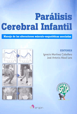 PARALISIS CEREBRAL INFANTIL