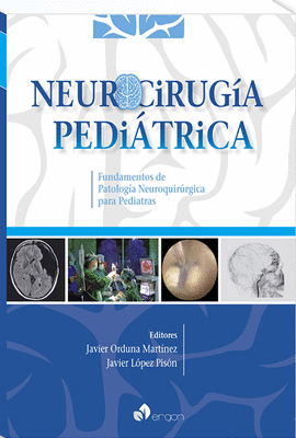 NEUROCIRUG�A PEDI�TRICA