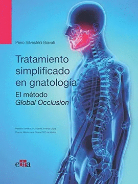 OCLUSIN GLOBAL : TRATAMIENTO SIMPLIFICADO EN GNATOLOGA