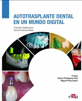 AUTOTRASPLANTE DENTAL EN UN MUNDO DIGITAL