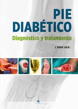 PIE DIABE�TICO
