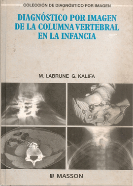 DIAGNOSTICO POR IMAGEN DE LA COLUMNA VERTEBRAL EN LA INFANCIA