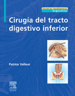 CIRUGIA DEL TRACTO DIGESTIVO INFERIOR