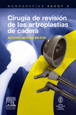 CIRUGIA DE REVICION DE LAS ARTOPLASTIAS DE CADERA