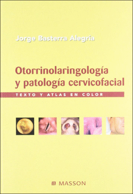 OTORRINOLARINGOLOGA Y PATOLOGA CERVICOFACIAL