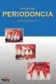 ATLAS DE PERIODONCIA