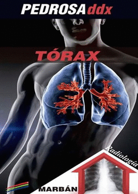 TORAX PEDROSA DDX