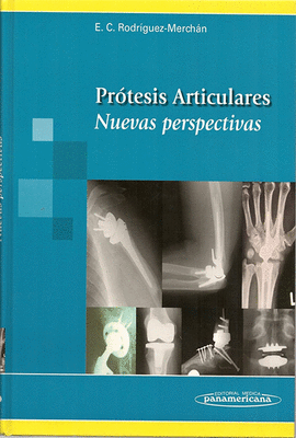 PROTESIS ARTICULARES NUEVAS PERSPECTIVAS