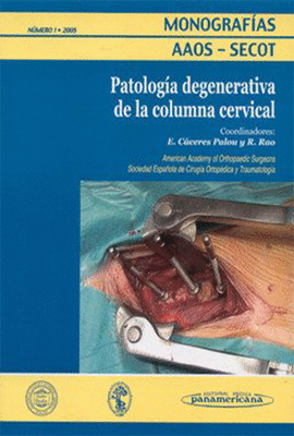 PATOLOGIA DEGENERATIVA DE LA COLUMNA CERVICAL