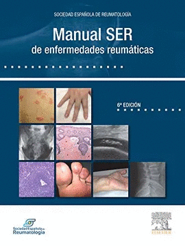 MANUAL S.E.R DE LAS ENFERMEDADES REUMATICAS