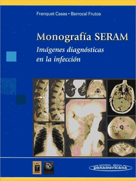 MONOGRAFIA SERAM IMAGENES DIAGNOSTICAS EN LA INFECCION