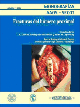 FRACTURAS DEL HUMERO PROXIMAL - MONOGRAFIAS AAOS-SECOT