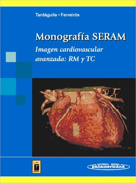 MONOGRAFIA SERAM IMAGEN CARDIOVASCULAR AVANZADA: RM Y TC