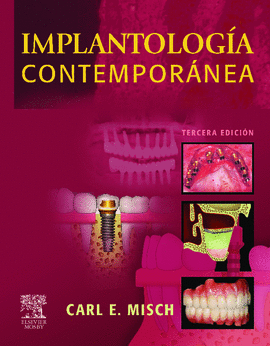 IMPLANTOLOGIA CONTEMPORANEA