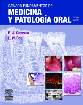 CAWSON FUNDAMENTOS DE MEDICINA Y PATOLOGIA ORAL