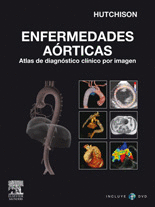 ENFERMEDADES AORTICAS + DVD ATLAS DE DIAGNOSTICO CLINICO POR IMAGEN