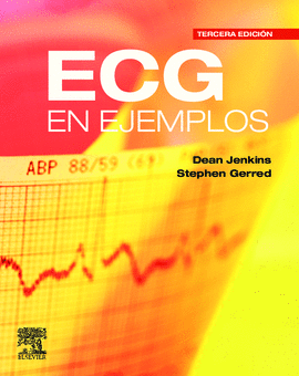 ECG EN EJEMPLOS