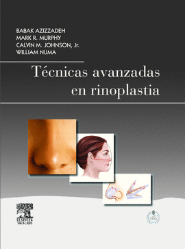 TECNICAS AVANZADAS EN RINOPLASTIA