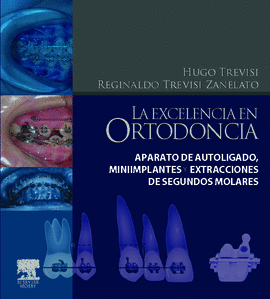 LA EXCELENCIA EN ORTODONCIA APARATO DE AUTOLIGADO MINIPLANTES EXTRACCIONES DE SEGUNDOS MOLARES