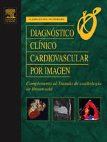 DIAGNOSTICO CLINICO CARDIOVASCULAR POR IMAGEN COMPLEMENTO AL TRATADO DE CARDIOLOGIA DE BRAUNWALD