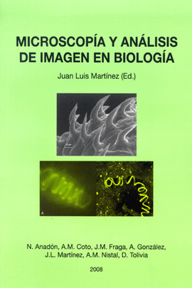 MICROSCOPIA Y ANALISIS DE IMANGE EN BIOLOGIA