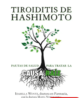 TIROIDITIS DE HASHIMOTO