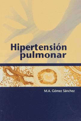 HIPERTENSION PULMONAR