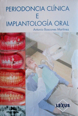 PERIODONCIA CLINICA E IMPLANTOLOGIA ORAL