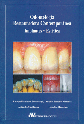 ODONTOLOGIA RESTAURADORA CONTEMPORANEA IMPLANTES Y ESTETICA