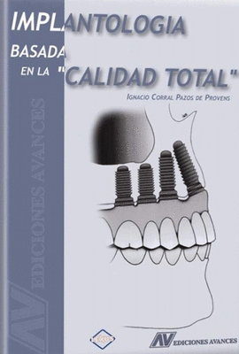 IMPLANTOLOGIA BASADA EN LA CALIDAD TOTAL