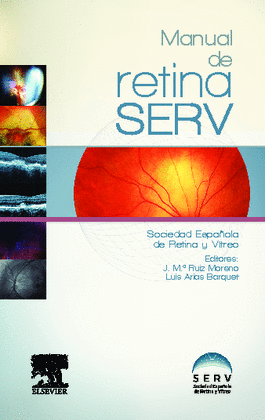 MANUAL DE RETINA SERV