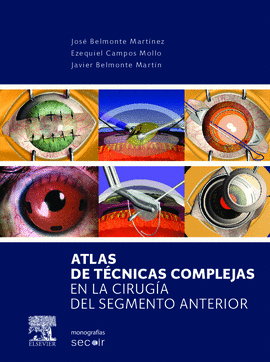 ATLAS DE TCNICAS COMPLEJAS EN LA CIRUGA DEL SEGMENTO ANTERIOR