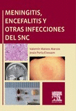 MENINGITIS ENCEFALITIS Y OTRAS INFECCIONES DEL SNC