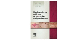 MANIFESTACIONES CUTANEAS DE NEOPLASIAS MALIGNAS INTERNAS