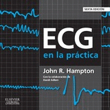 ECG EN LA PRACTICA