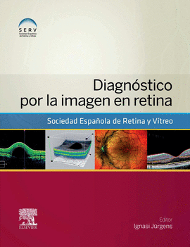 DIAGNSTICO POR LA IMAGEN EN RETINA