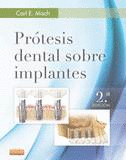 PROTESIS DENTAL SOBRE IMPLANTES