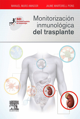 MONITORIZACION INMUNOLOGICA DEL TRASPLANTE