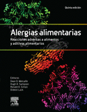 ALERGIAS ALIMENTARIAS