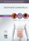 ESOFAGITIS EOSINOFLICA