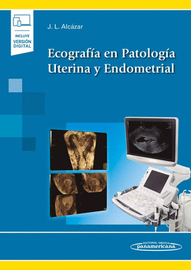 ECOGRAFA EN PATOLOGA UTERINA Y ENDOMETRIAL