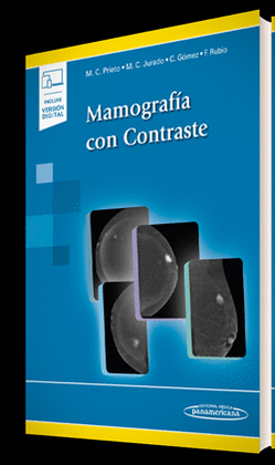 MAMOGRAFA CON CONTRASTE