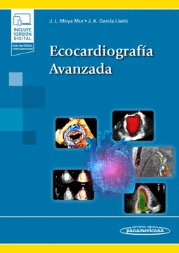 ECOCARDIOGRAF�A AVANZADA
