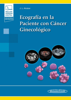 ECOGRAFIA EN LA PACIENTE CON CANCER GINECOLOGICO