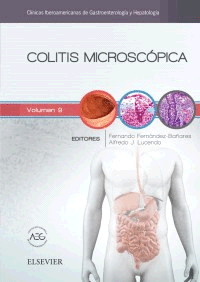 COLITIS MICROSCÓPICA