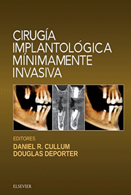 CIRUGIA IMPLANTOLOGICA MINIMAMENTE INVASIVA